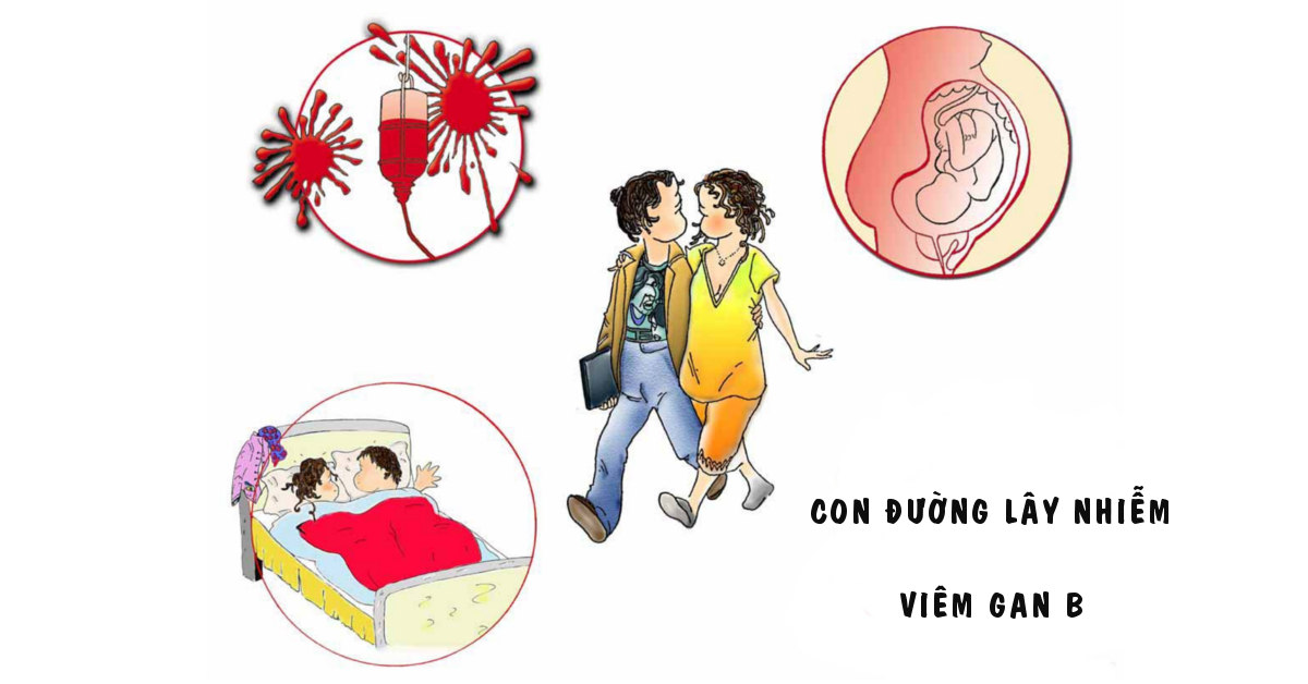 3 con đường lây nhiễm viêm gan B phổ biến