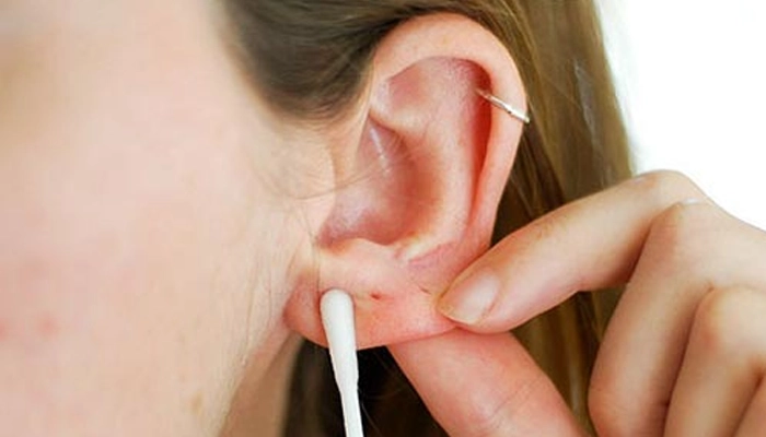 Sau khi bấm lỗ tai nên kiêng gì?