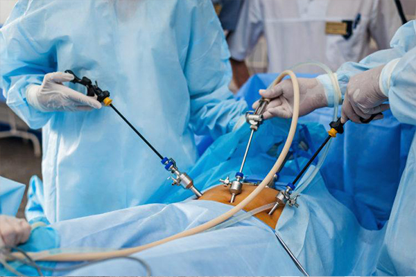 Nếu tình trạng bệnh sỏi túi mật nặng, cần phải phẫu thuật để loại bỏ sỏi 
