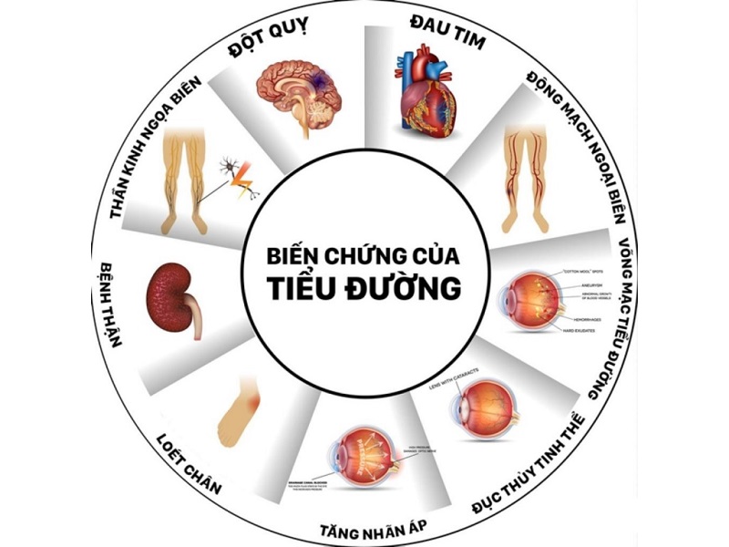 Tiểu đường tuýp 2 không chữa trị kịp thời sẽ gây biến chứng nguy hiểm