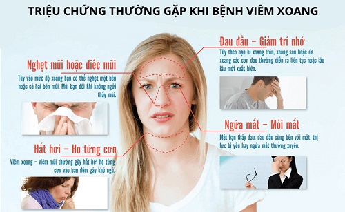 Các triệu chứng thường gặp của viêm xoang cấp