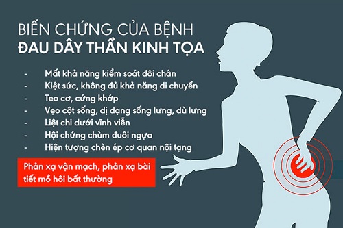 Biển chứng đau dây thần kinh tọa