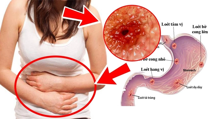 Tác Dụng Của Cát Cánh Đối Với Sức Khỏe Và Đường Hô Hấp