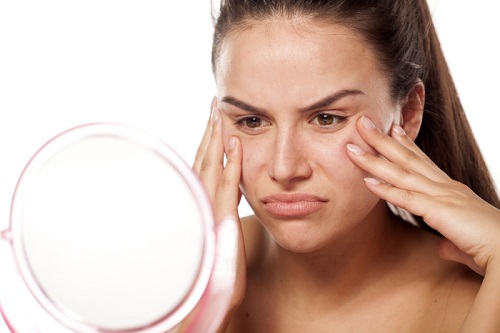 Chế độ ăn uống ảnh hưởng trực tiếp đến làn da dị ứng