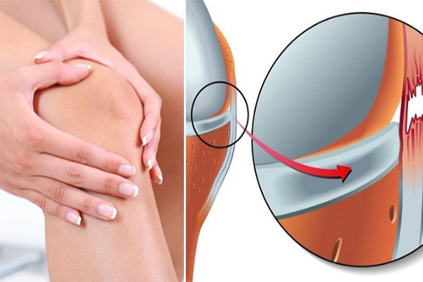 Đau dây chằng đầu gối gây ảnh hưởng đến khả năng vận động và di chuyển 