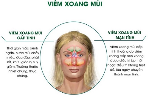 Viêm xoang là bệnh lý rất phổ biến hiện tại