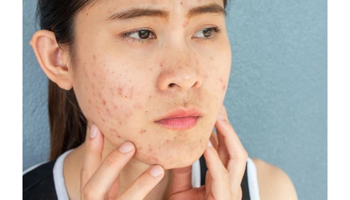 Thừa Vitamin B12: Hiểm Họa Âm Thầm Bạn Không Ngờ Tới